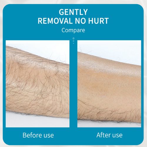 Canadian-Carto Bleame Hair Eraser